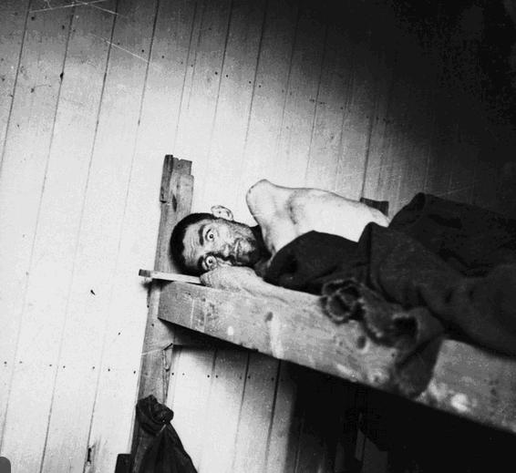 Un rescapé, très éprouvé par la détention, camp de Vaihingen, avril 1945.